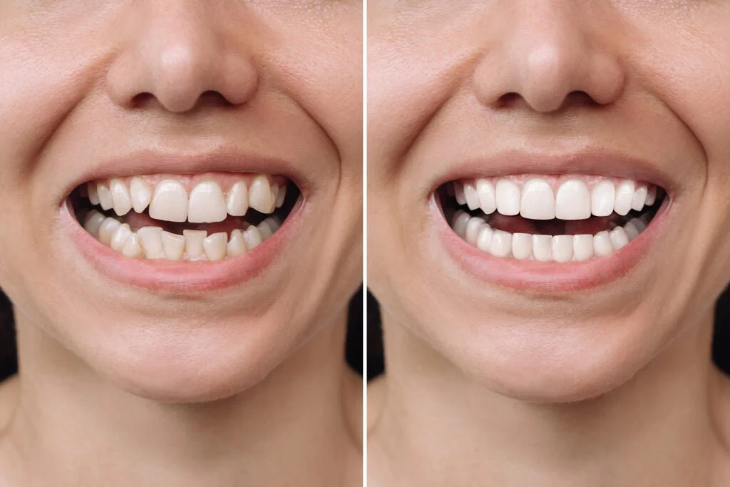 Loose teeth bite problems treatment near you