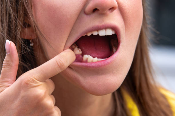 Missing teeth treatment near you
