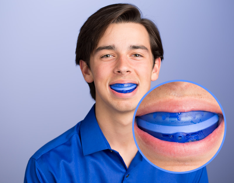 Mouth guards night guards near you