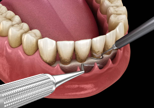 Periodontal therapy near you