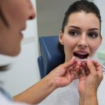 How Mouth Guards Help Treat Teeth Clenching